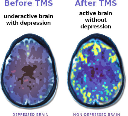 Brain scan